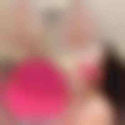 Masažna četka za čišćenje lica - 12 postavki brzine | STARGLO